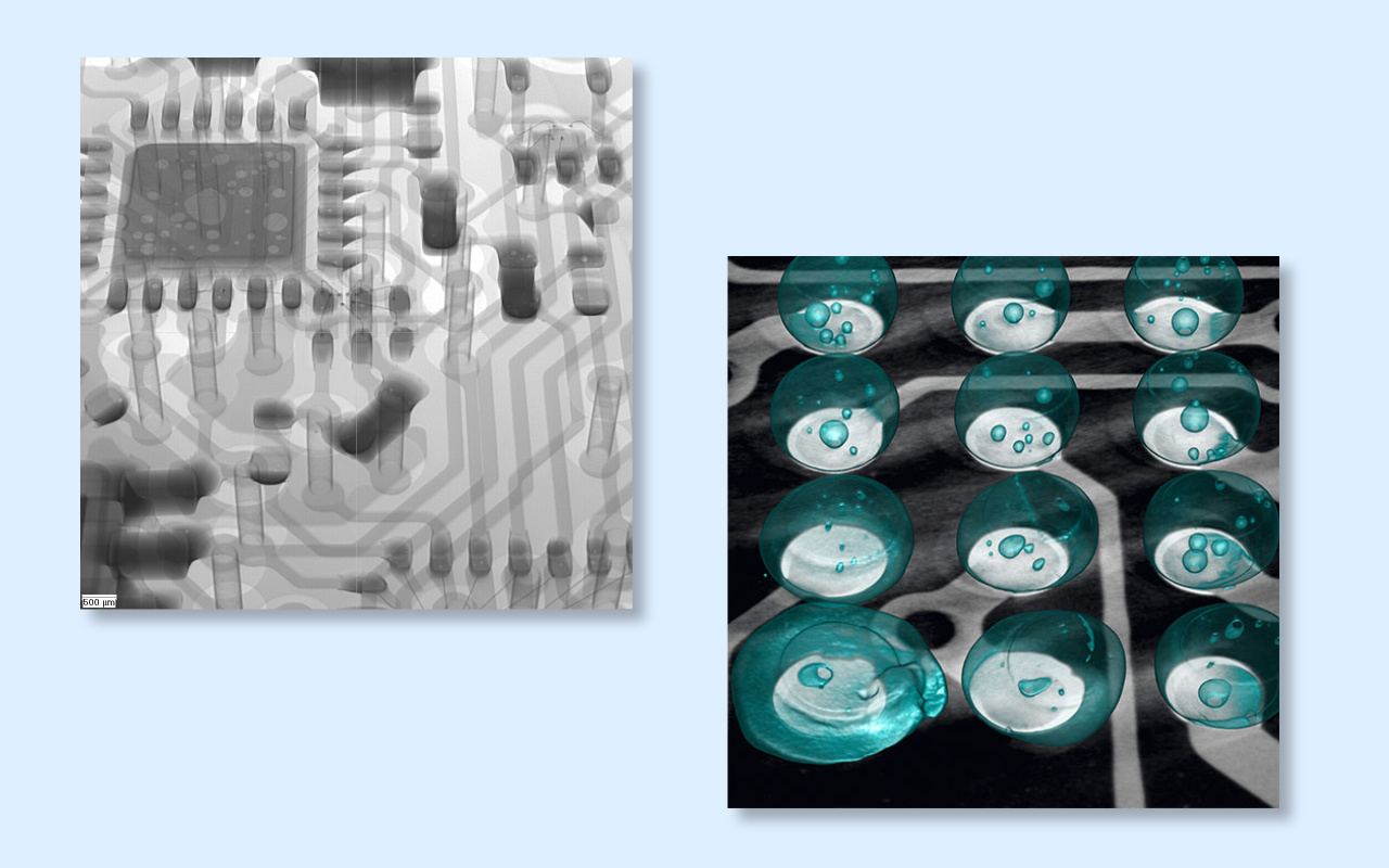 4. 2D vs 3D CT X-ray Which One Do You Really Need? 4. Radiografia TC 2D vs 3D Di quale hai veramente bisogno?
